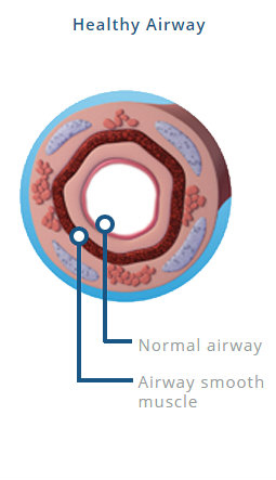 A healthy airway indicating a normal airway and airway smooth muscle.