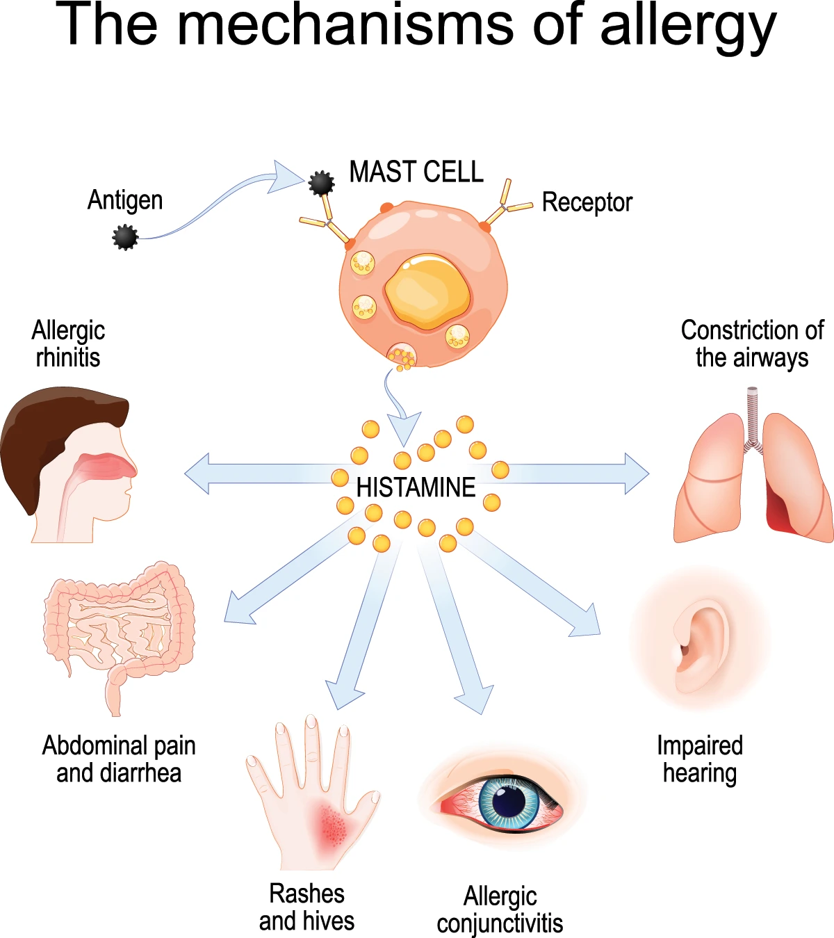 How an allergic reaction occurs